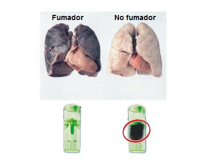 BioFilter: Los Riesgos de Fumar